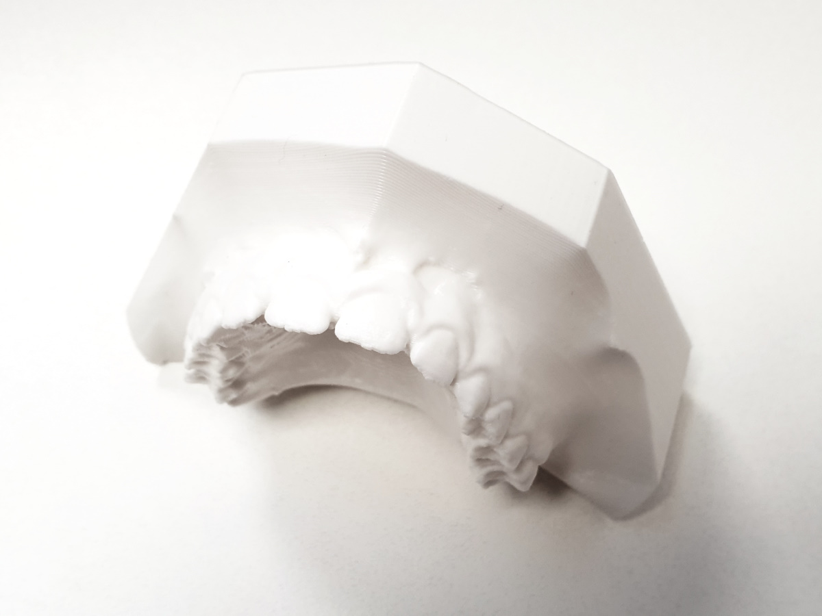 Orthodontie les moulages Laboratoire Orthodontic's — free download